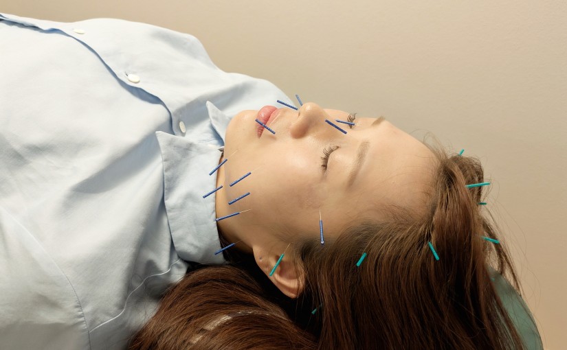 美容鍼の翌日が一番好きな理由｜お客さまの声から